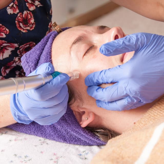 20% Off Microneedling 3 Pack